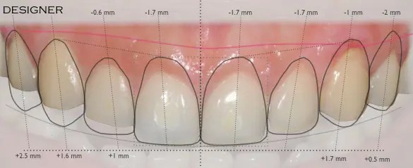 best dentist in miami,porcelain veneers miami,Botox miami,root canal cost miami,sinus lift miami,best veneers miami,best dentist south florida,best cosmetic dentist miami,best dental care miami,sage dental
