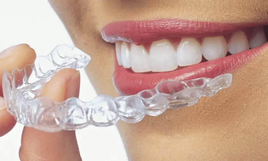 Clear aligners and Invisalign treatment at Dr. G Dental Studio Miami