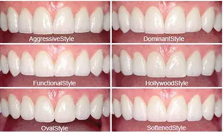 Porcelain veneer styles compared, Dr. G Dental Studio Miami